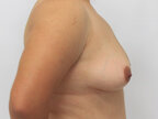 RGV Cosmetic Surgery Vein Care 