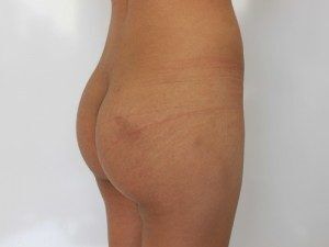 RGV Cosmetic Surgery Vein Care 