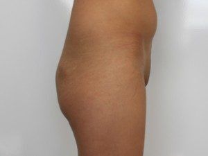 RGV Cosmetic Surgery Vein Care 
