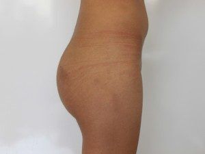 RGV Cosmetic Surgery Vein Care 
