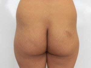 RGV Cosmetic Surgery Vein Care 