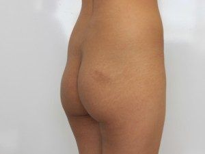 RGV Cosmetic Surgery Vein Care 