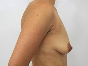 RGV Cosmetic Surgery Vein Care 