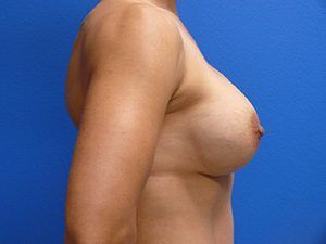 RGV Cosmetic Surgery Vein Care 