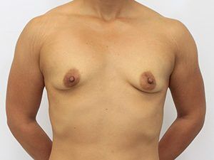 RGV Cosmetic Surgery Vein Care 