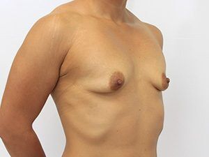 RGV Cosmetic Surgery Vein Care 