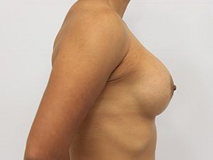 RGV Cosmetic Surgery Vein Care 