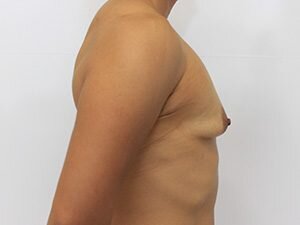 RGV Cosmetic Surgery Vein Care 