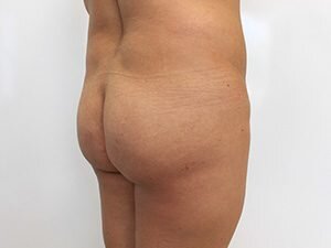 RGV Cosmetic Surgery Vein Care 