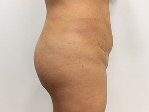 RGV Cosmetic Surgery Vein Care 