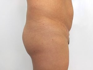 RGV Cosmetic Surgery Vein Care 