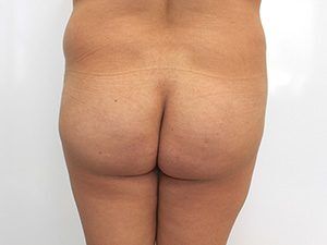 RGV Cosmetic Surgery Vein Care 