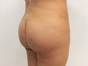 RGV Cosmetic Surgery Vein Care 