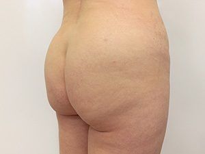 RGV Cosmetic Surgery Vein Care 