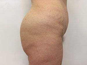 RGV Cosmetic Surgery Vein Care 
