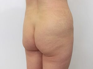 RGV Cosmetic Surgery Vein Care 
