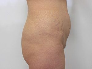 RGV Cosmetic Surgery Vein Care 