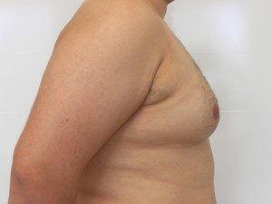 RGV Cosmetic Surgery Vein Care 