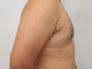 RGV Cosmetic Surgery Vein Care 