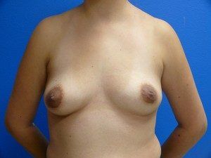 RGV Cosmetic Surgery Vein Care 
