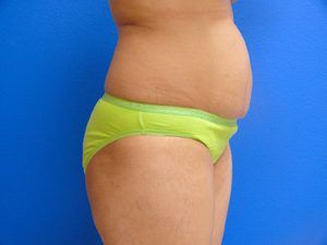 RGV Cosmetic Surgery Vein Care 