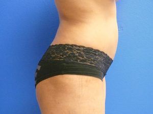 RGV Cosmetic Surgery Vein Care 
