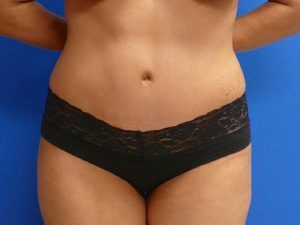 RGV Cosmetic Surgery Vein Care 