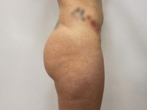RGV Cosmetic Surgery Vein Care 
