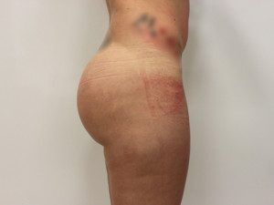 RGV Cosmetic Surgery Vein Care 