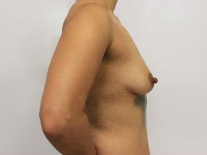 RGV Cosmetic Surgery Vein Care 