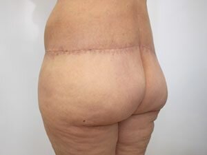 RGV Cosmetic Surgery Vein Care 