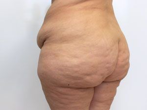 RGV Cosmetic Surgery Vein Care 