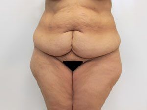 RGV Cosmetic Surgery Vein Care 