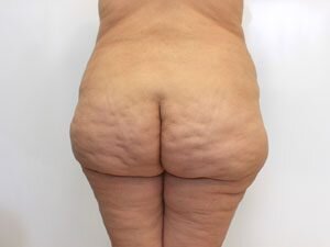 RGV Cosmetic Surgery Vein Care 