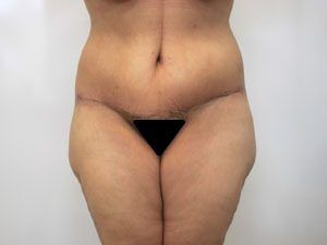 RGV Cosmetic Surgery Vein Care 