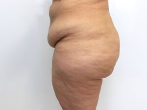 RGV Cosmetic Surgery Vein Care 