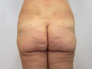 RGV Cosmetic Surgery Vein Care 