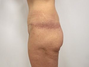 RGV Cosmetic Surgery Vein Care 