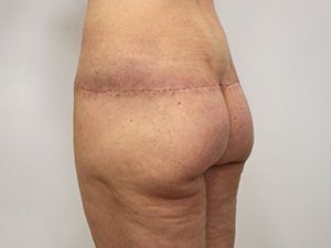 RGV Cosmetic Surgery Vein Care 