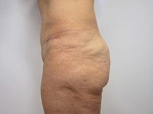 RGV Cosmetic Surgery Vein Care 