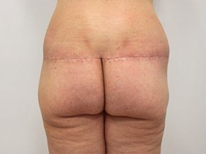 RGV Cosmetic Surgery Vein Care 