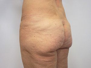 RGV Cosmetic Surgery Vein Care 