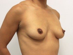 RGV Cosmetic Surgery Vein Care 