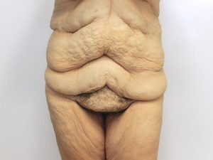 RGV Cosmetic Surgery Vein Care 