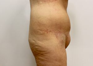RGV Cosmetic Surgery Vein Care 