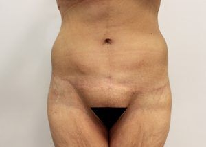 RGV Cosmetic Surgery Vein Care 