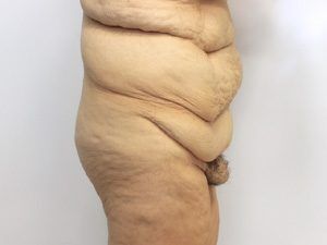 RGV Cosmetic Surgery Vein Care 