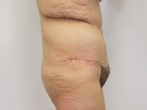 RGV Cosmetic Surgery Vein Care 