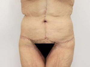 RGV Cosmetic Surgery Vein Care 