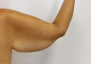 RGV Cosmetic Surgery Vein Care 